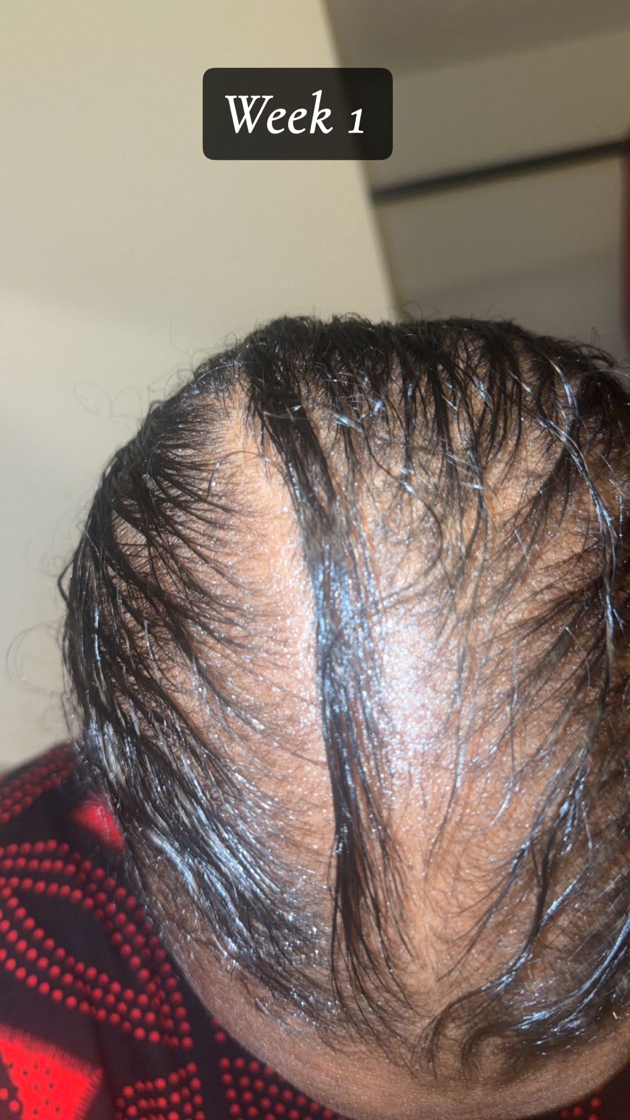 Bellaziva – Grow Your Hair Back