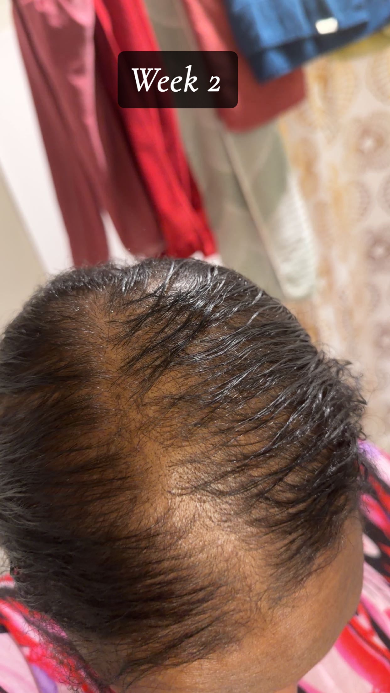 Bellaziva – Grow Your Hair Back