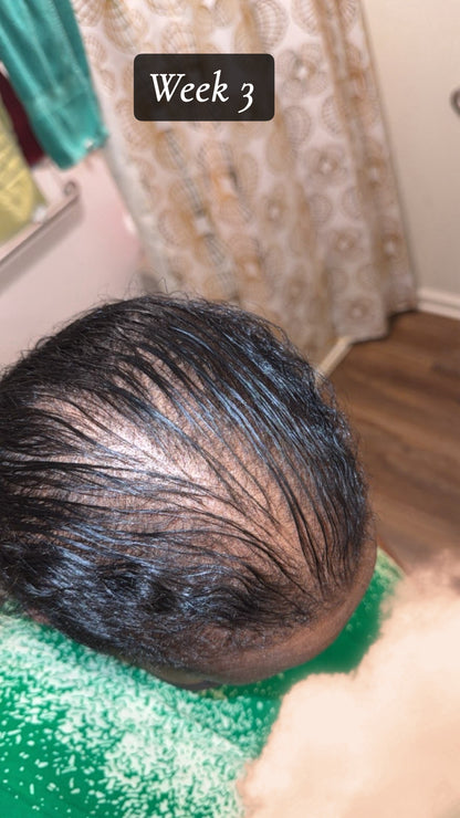 Bellaziva – Grow Your Hair Back