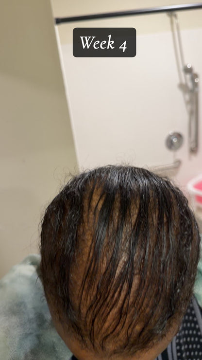 Bellaziva – Grow Your Hair Back